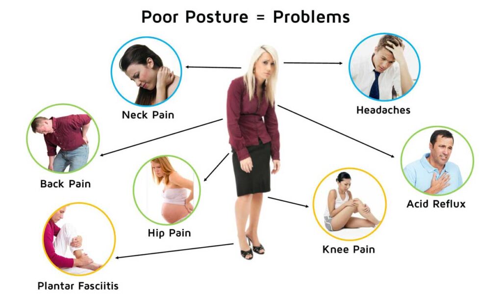 Poor Posture Problems