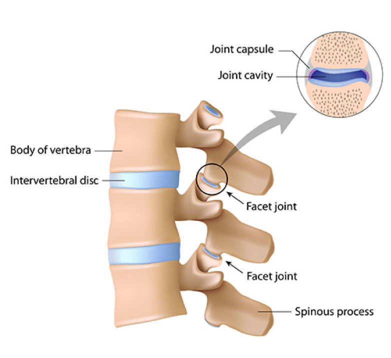 WHAT CAUSES NECK PAIN & TREATMENTS AVAILABLE FOR IT