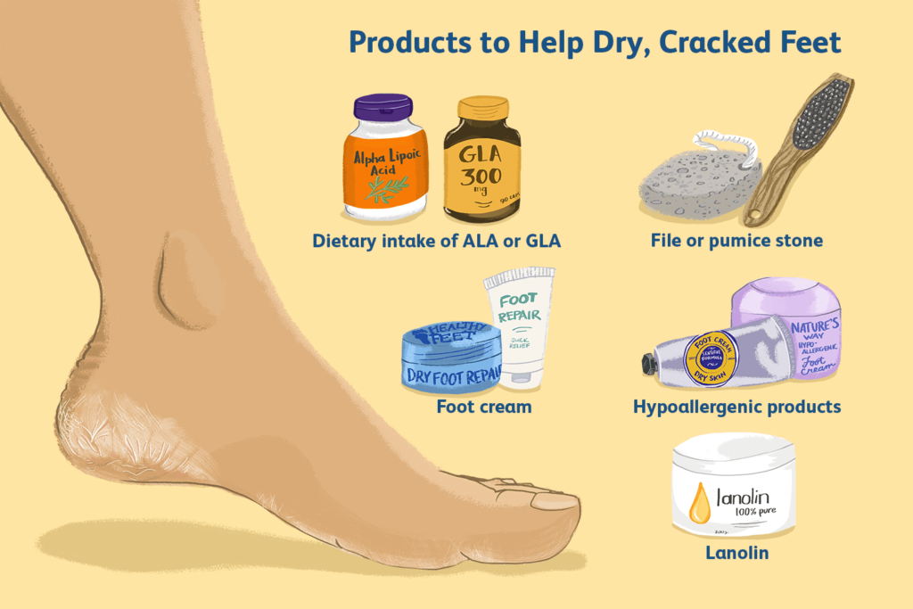 Products to Help Dry, Cracked Feet