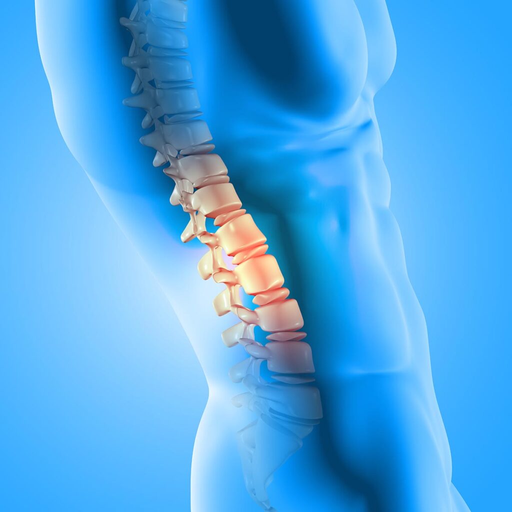 Causes For Developing Degenerative Disc Disease