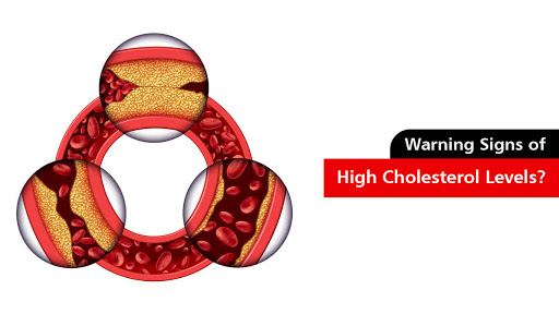 warning signs of high cholesterol levels