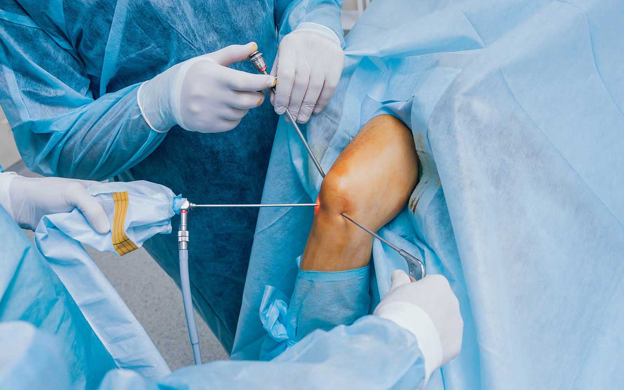 Knee Joint Surgery