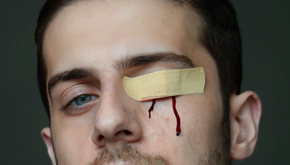 MOST COMMON 7 EYE INJURIES