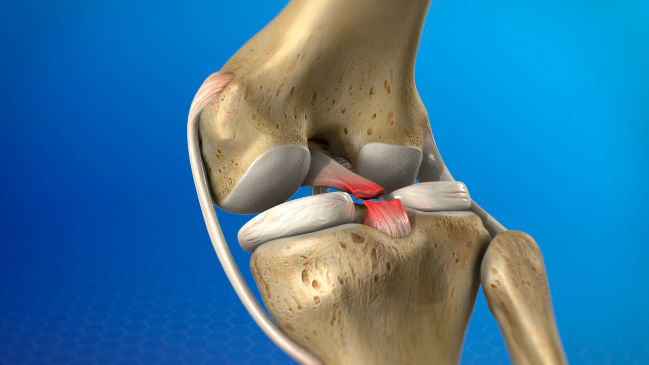 What is Posterior Cruciate Ligament?