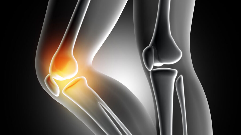 Pain in the knee joint