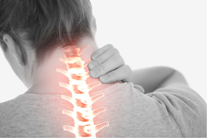 CHIROPRACTIC TREATMENT FOR SEVERE NECK PAIN