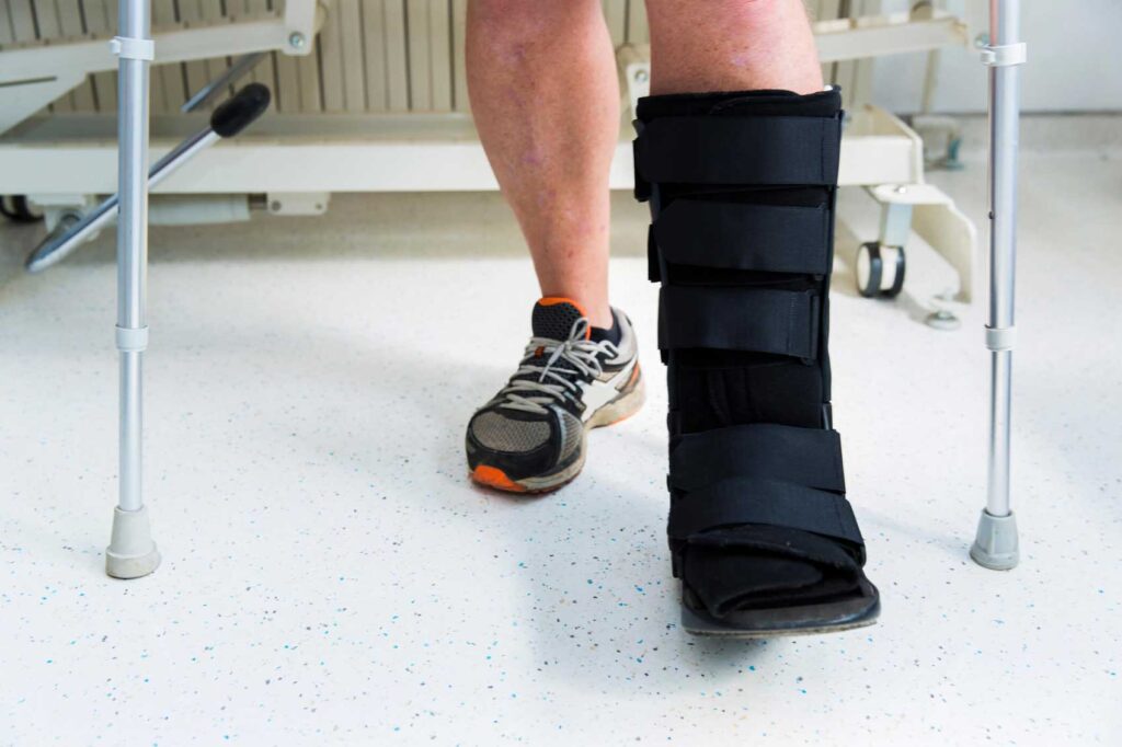 OPERATIVE TREATMENT FOR ANKLE FRACTURES