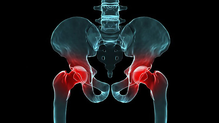 SACROILIITIS JOINT PAIN TREATMENT